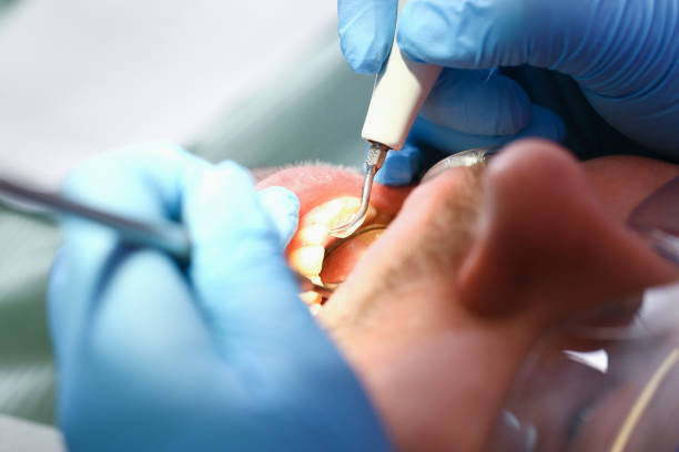 Best Emergency Treatment for Oral Infections in Flora, IN