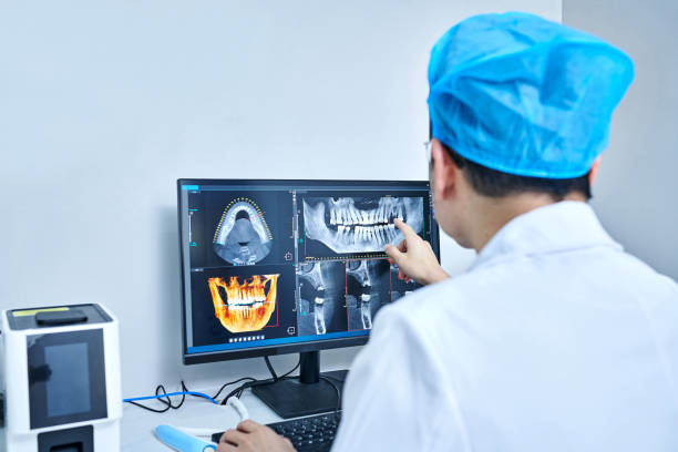 Best Dental Abscess Treatment in Flora, IN